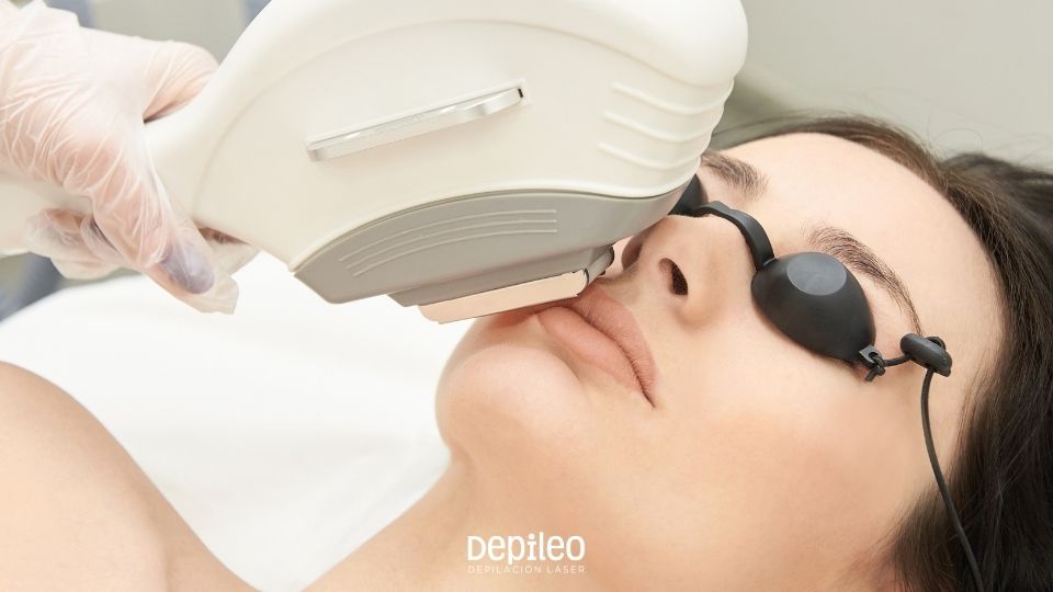 Tratamiento seguro de depilación láser facial en Lorca. Depilación láser facial para eliminar el vello del rostro en Lorca.