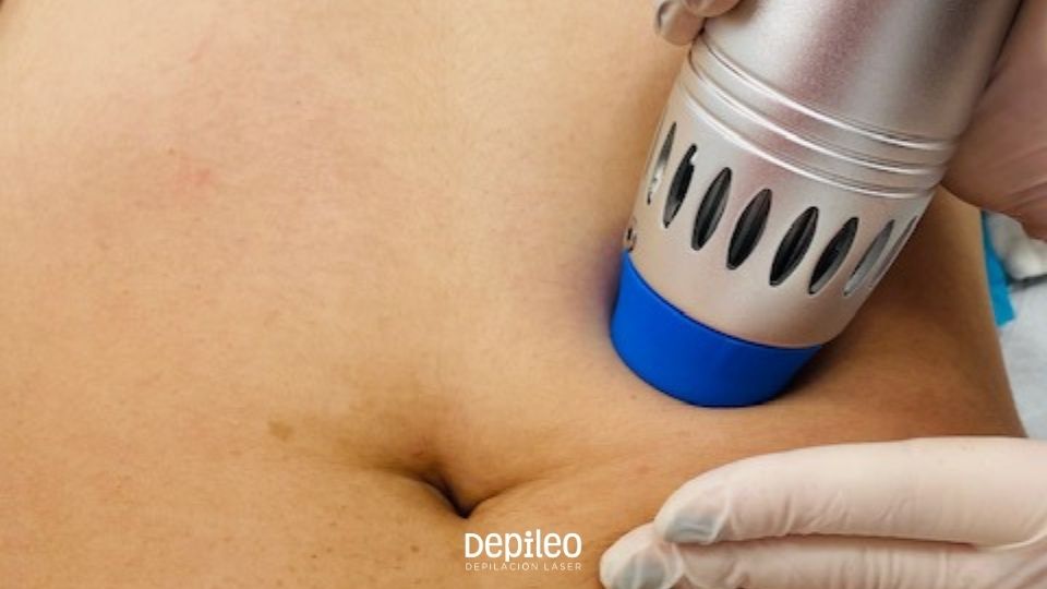 Estimula la circulación y mejora la textura de la piel mientras reduce la grasa localizada. Sesión de ondas de choque en muslos enfocada en reducir celulitis y combatir la grasa localizada.