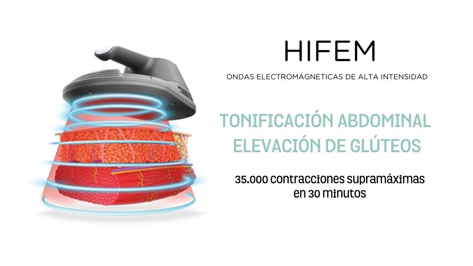 hifem, ondas electromagnéticas focalizadas de alta intensidad Resultado de un tratamiento Musculpt HIFEM: abdomen más definido y firme.