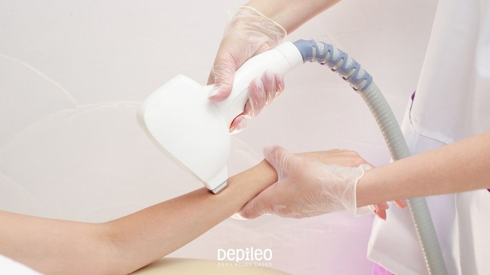 Mujer recibiendo una sesión de depilación láser en los brazos en Depileo, Murcia.