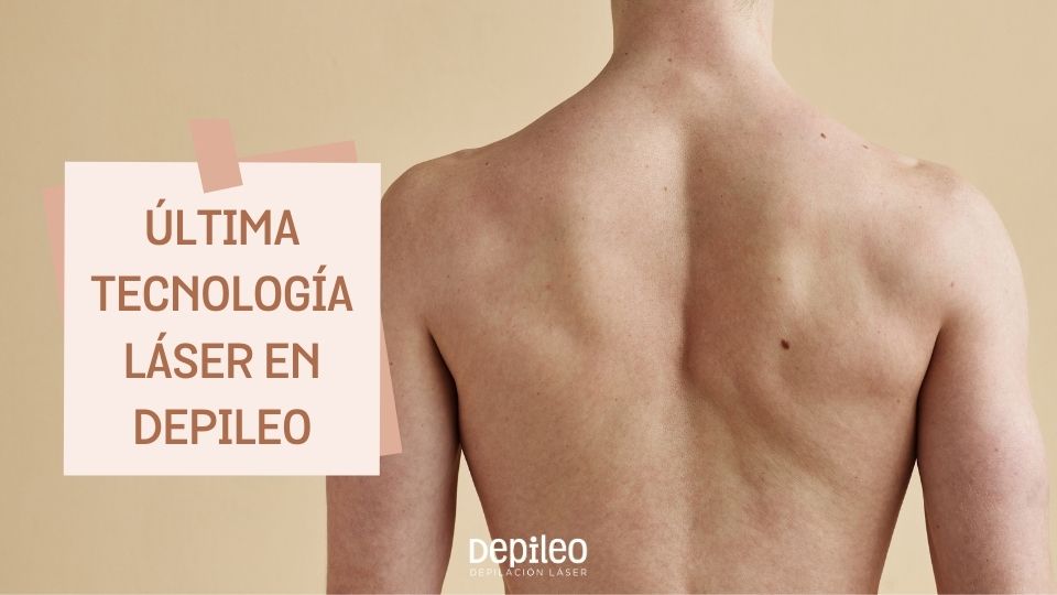 Resultados avanzados en depilación SHR en espalda masculina Hombre recibiendo depilación láser SHR para la espalda.