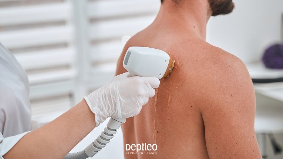 Depilación láser en la espalda con tecnología SHR en Murcia Hombre recibiendo una sesión de depilación láser en la espalda con tecnología SHR en Murcia