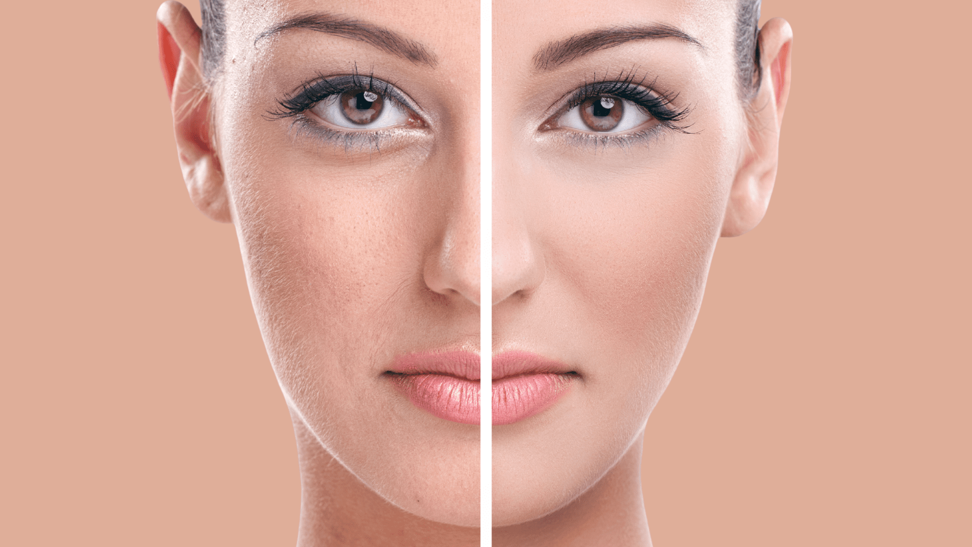 Limpieza facial profunda en Murcia 